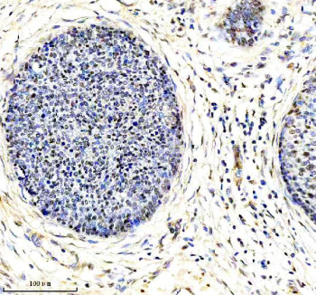 Immunohistochemical staining of using anti-ARL2 antibody. was detected in a paraffin-embedded sectio