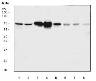 Western blot testing of 1) human HepG2, 2) human HCCT, 3) human HCCP, 4) human placenta, 5) rat live