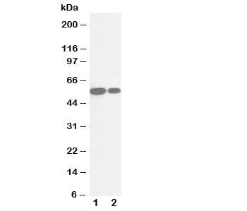 Cytochrome P450 2E1 Antibody