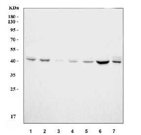 uPAR Antibody / uPA Receptor