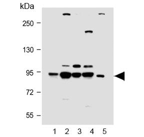 Western blot testing of human 1) A431, 2) Jurkat, 3) MCF7, 4) K562 and 5) rat brain lysate with PI3K