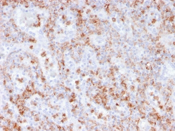 S100A9 Antibody / MRP14 / Calgranulin B / Calprotectin L1H