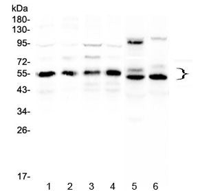 Western blot testing of human 1) HeLa, 2) COLO320, 3) A431, 4) MCF7, 5) rat heart and 6) mouse heart