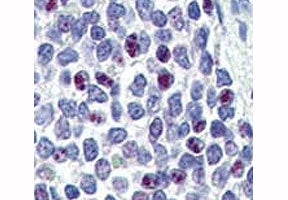 IHC analysis of FFPE human spleen tissue stained with KLF4 antibody