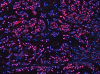 UBE2M Antibody / UBC12