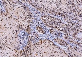 SHP-1 Antibody / PTPN6