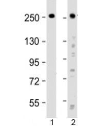 Western blot testing of human 1) HeLa and 2) SH-SY5Y cell lysate with ROBO1 antibody at 1:2000. Expe