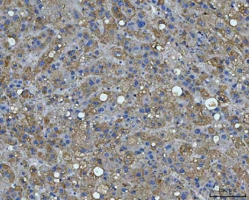 BI-1 Antibody / Bax inhibitor 1 / TMBIM6