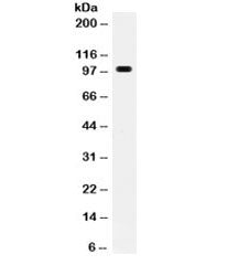 RANK Antibody