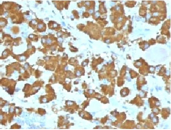 IHC testing of FFPE human pituitary gland with Growth Hormone antibody (clone GRHP1-1). Required HIE