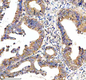 Immunohistochemical staining of HTR3E using anti-HTR3E antibody. HTR3E was detected in a paraffin-em