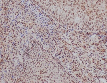 Ku70 Antibody / XRCC6