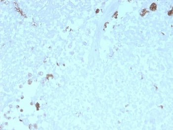 IHC staining of FFPE human uterus with recombinant ATG5 antibody. HIER: boil tissue sections in pH 9