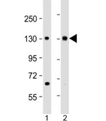 Western blot testing of human 1) HeLa and 2) Jurkat cell lysate with MTUS1 antibody at 1:2000. Predi