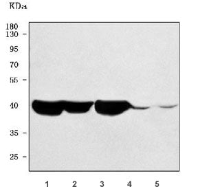 ST6GalNAc II Antibody / ST6GALNAC2