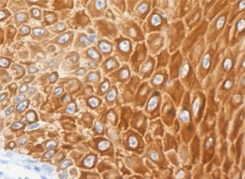 IHC testing of FFPE human skin with recombinant Cytokeratin 16 antibody (clone CTKN16-1R). Required 