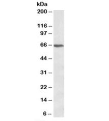 Western blot testing of Jurkat lysate with CACNB2 antibody at 1ug/ml. Predicted molecular weight: ~6