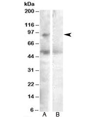 SULF2 Antibody