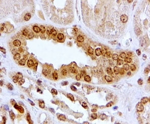 IHC testing of FFPE human kidney with Aryl Hydrocarbon Receptor antibody at 2ug/ml. HIER: steamed wi
