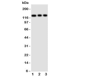 Western blot testing of TLR10 antibody and Lane 1: HeLa; 2: Jurkat; 3: CEM cell lysate. Observed siz