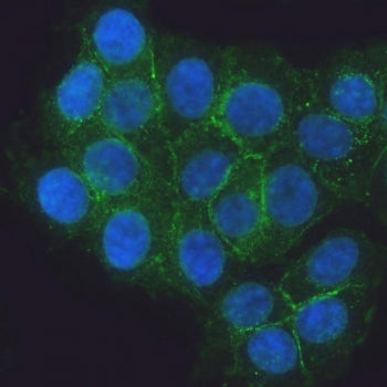 Immunofluorescent staining of FFPE human MCF7 cells with E-Cadherin antibody (green) and DAPI nuclea