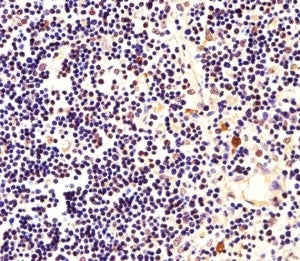Immunohistochemical analysis of paraffin-embedded human thymus using Nucleophosmin antibody at 1:25 