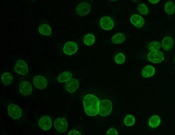 TPR Antibody / Translocated promoter region protein