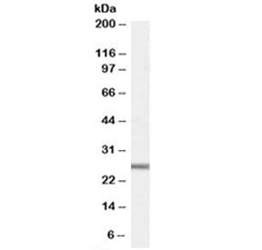 Western blot testing of mouse heart lysate with GPX3 antibody at 1ug/ml. Expected molecular weight: 