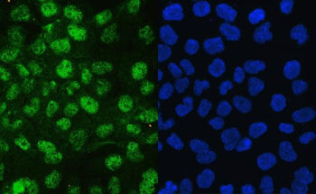 Immunofluorescent staining of FFPE human A431 cells with JAB1 antibody (green) and DAPI nuclear stai