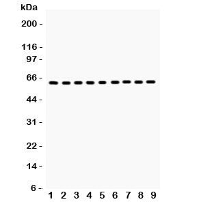 HSP60 Antibody