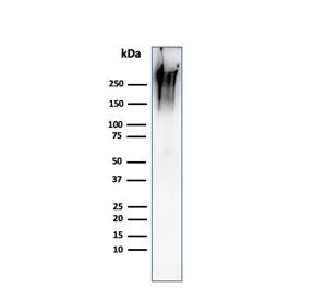 Western blot testing of human MCF7 cell lysate with recombinant MUC1 antibody (clone MUC1/2980R). Th