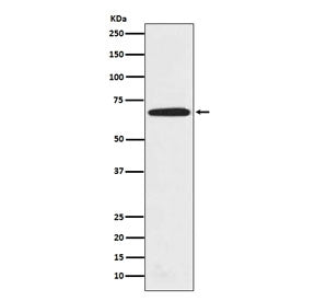 Western blot testing of human HeLa cell lysate with PRMT5 antibody. Expected molecular weight ~72 kD
