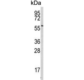 Western blot testing of human NCI-H460 cell lysate with Beta-secretase 1 antibody. Predicted molecul