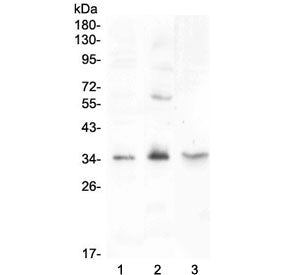 Fibroblast Growth Factor 23 / FGF-23 Antibody