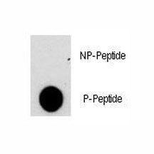 Dot blot analysis of phospho-NFATC2 antibody. 50ng of phos-peptide or nonphos-peptide per dot were s