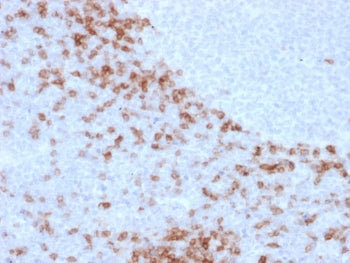 IHC staining of FFPE human lymph node with human IgD antibody (clone IgD26). HIER: boil tissue secti