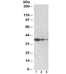 Western blot testing of human liver lysate [lane 1], mouse liver [lane 2] and rat liver [lane 3] wit