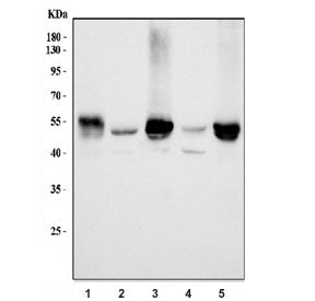 ALDH1B1 Antibody