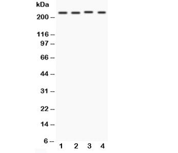 Western blot testing of NOTCH1 antibody and Lane 1: MCF-7; 2: HeLa; 3: Jurkat; 4: COLO320. Predicted