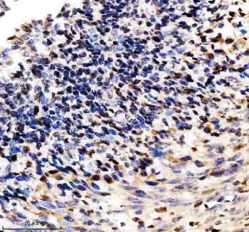 Immunohistochemical staining of SP110 using anti-SP110 antibody. SP110 was detected in a paraffin-em