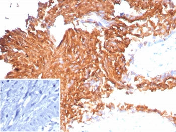 Uroplakin 1B Antibody / UPK1B