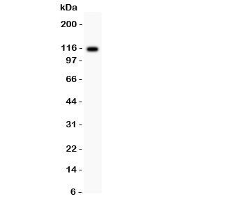 Western blot testing of C5 antibody and rat liver lysate; Predicted molecular weight: ~115 kDa (C5 alpha chain).