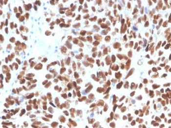 IHC staining of FFPE human bladder tissue with p53 antibody (clone TP53/3890R). HIER: boil tissue se