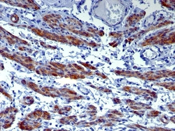 Caldesmon / CAD Antibody HMW