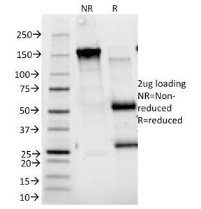CD25 Antibody / IL2RA
