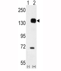 Western blot analysis of TIE2 antibody and 293 cell lysate either nontransfected (Lane 1) or transie