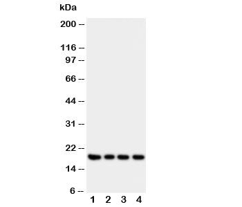 Western blot testing of Interferon gamma antibody and Lane 1: recombinant human protein 10ng; 2: 5ng