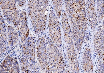 CDK2 Antibody