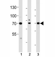Western blot analysis of lysate from (1) HeLa, (2) HepG2 and (3) human placenta tissue lysate using 