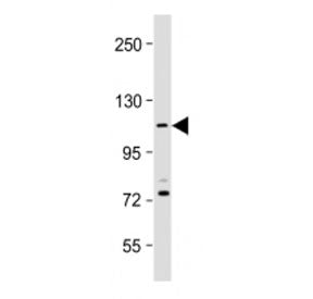 Western blot testing of PKN1 antibody at 1:2000 dilution + human Jurkat whole cell lysate. Predicted